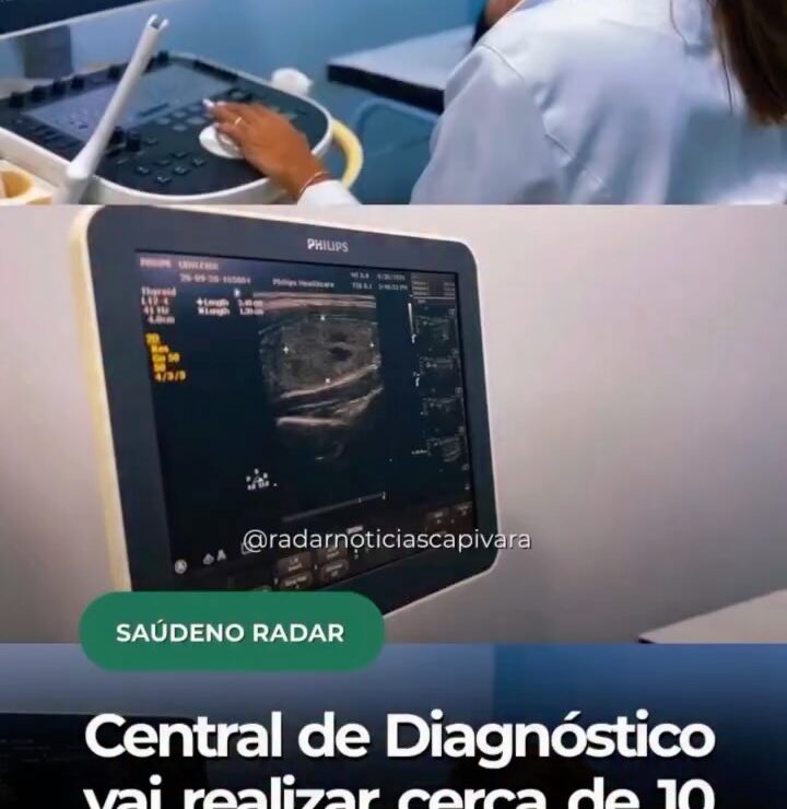 Central de Diagnóstico vai realizar cerca de 10 mil exames por mês